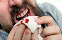 Apa Batal Wudhu Jika Mulut Berdarah