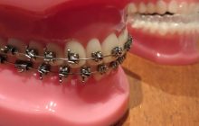 Hukum Merapihkan dan Mempercantik Gigi