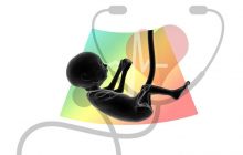 Menyimpan Tali Pusar Bayi